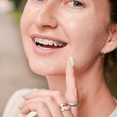 Brakets de Zafiro